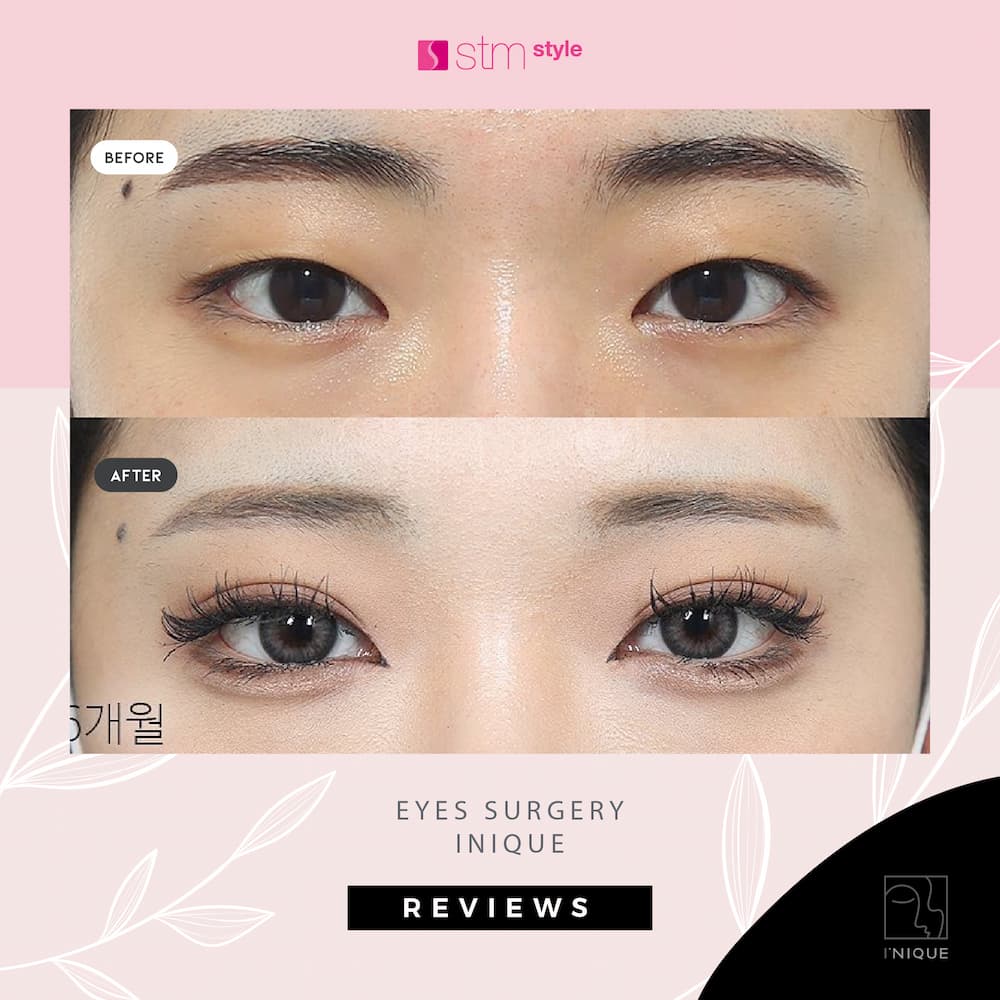 inique-review-eye-041