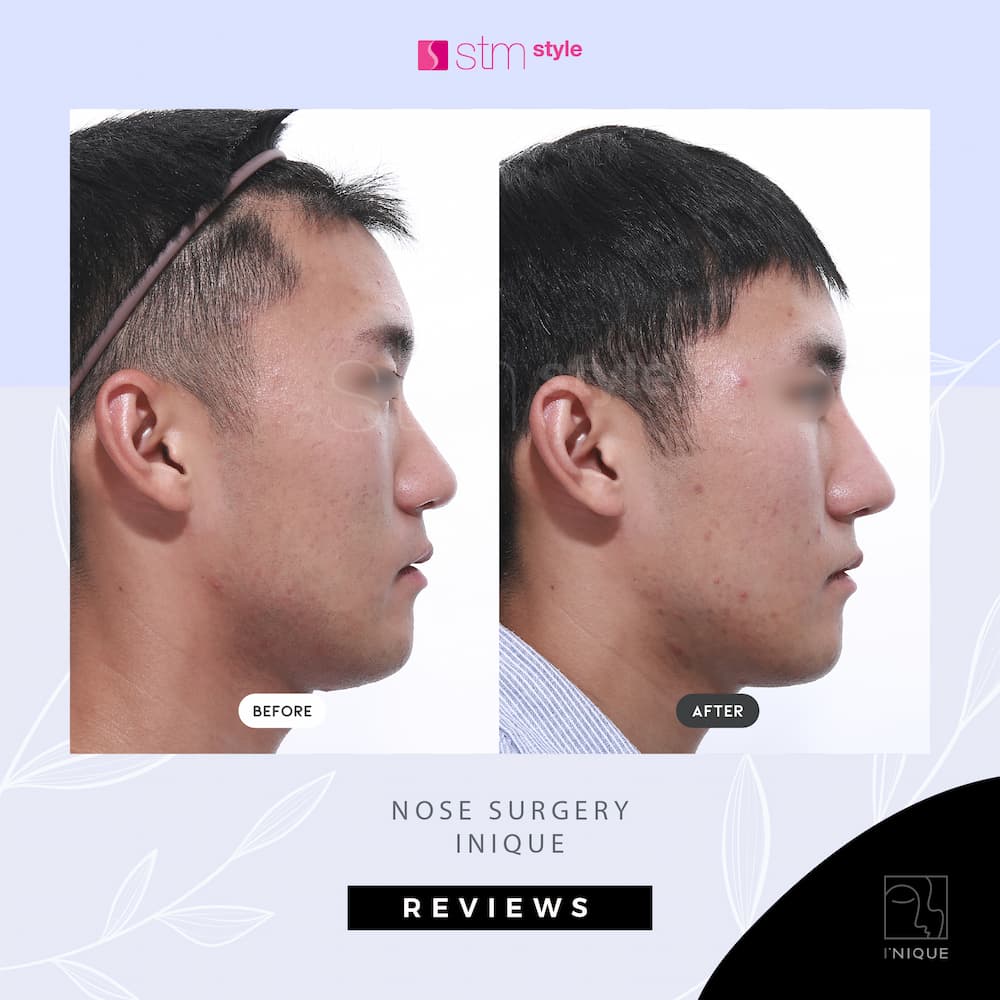 inique-review-nose-006