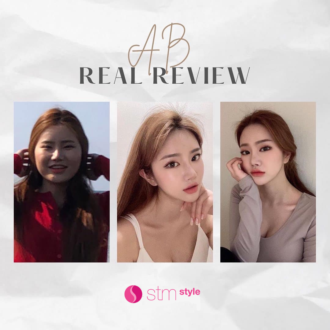 ศัลยกรรมโครงหน้าโรงพยาบาล AB รีวิวปรับโครงหน้าเกาหลี ศัลยกรรมโครงหน้าเกาหลี รีวิวศัลยกรรมโครงหน้า STMstyle เอเจนซี่ศัลยกรรมเกาหลี