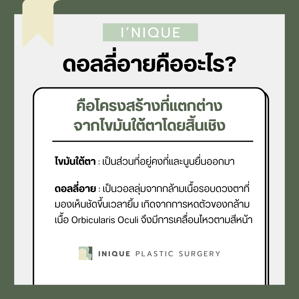 ดอลลี่อาย คืออะไร?