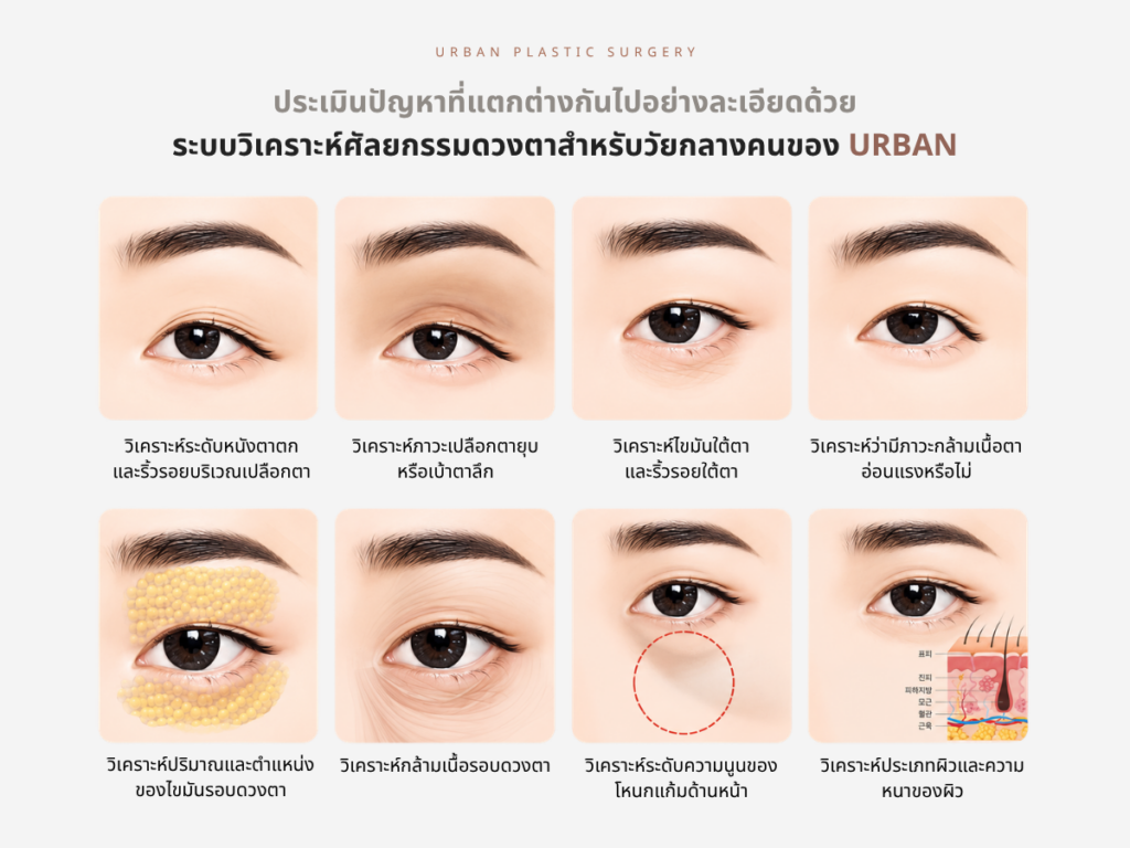 วิเคราะห์โครงสร้างดวงตา ก่อน ศัลยกรรมถุงใต้ตา