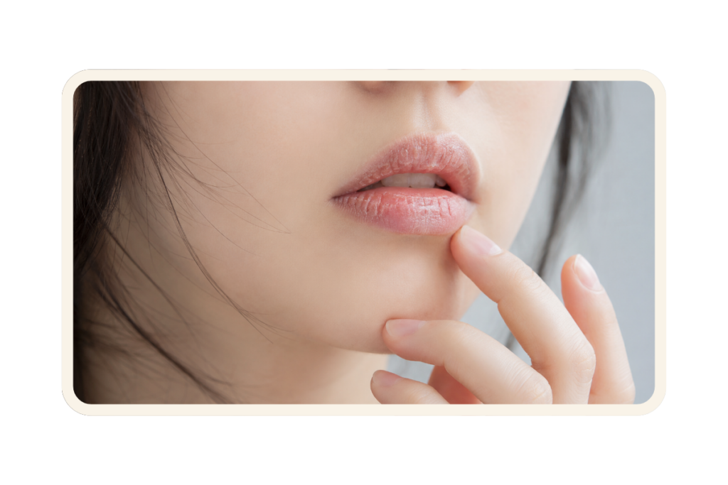 ปากแห้งและแผลถลอกรอบริมฝีปาก
ผลข้างเคียงจากการผ่าตัดขากรรไกร EP. 2