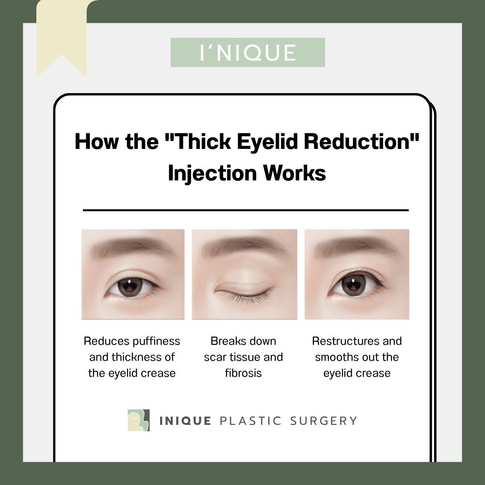 How INIQUE’s Sausage Eyelid Injection Works: Non-Surgical Correction for Thick, Puffy Double Eyelid Folds 