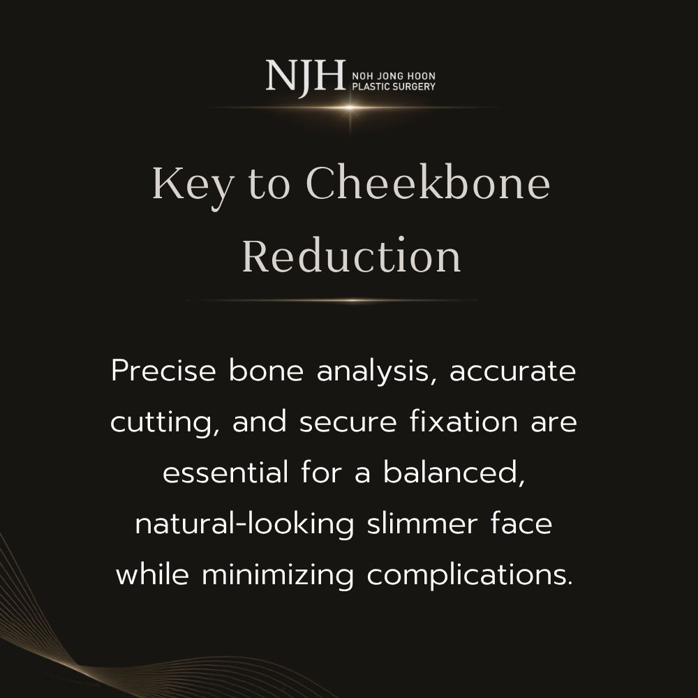 Key Factors for Successful Cheekbone Reduction Surgery (Zygoma Reduction Surgery)