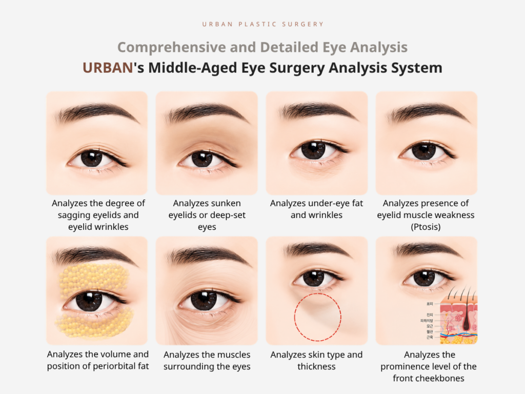 Under-Eye Bag Surgery for Middle-Aged Patients: Lower Blepharoplasty Techniques and Treatment Options
