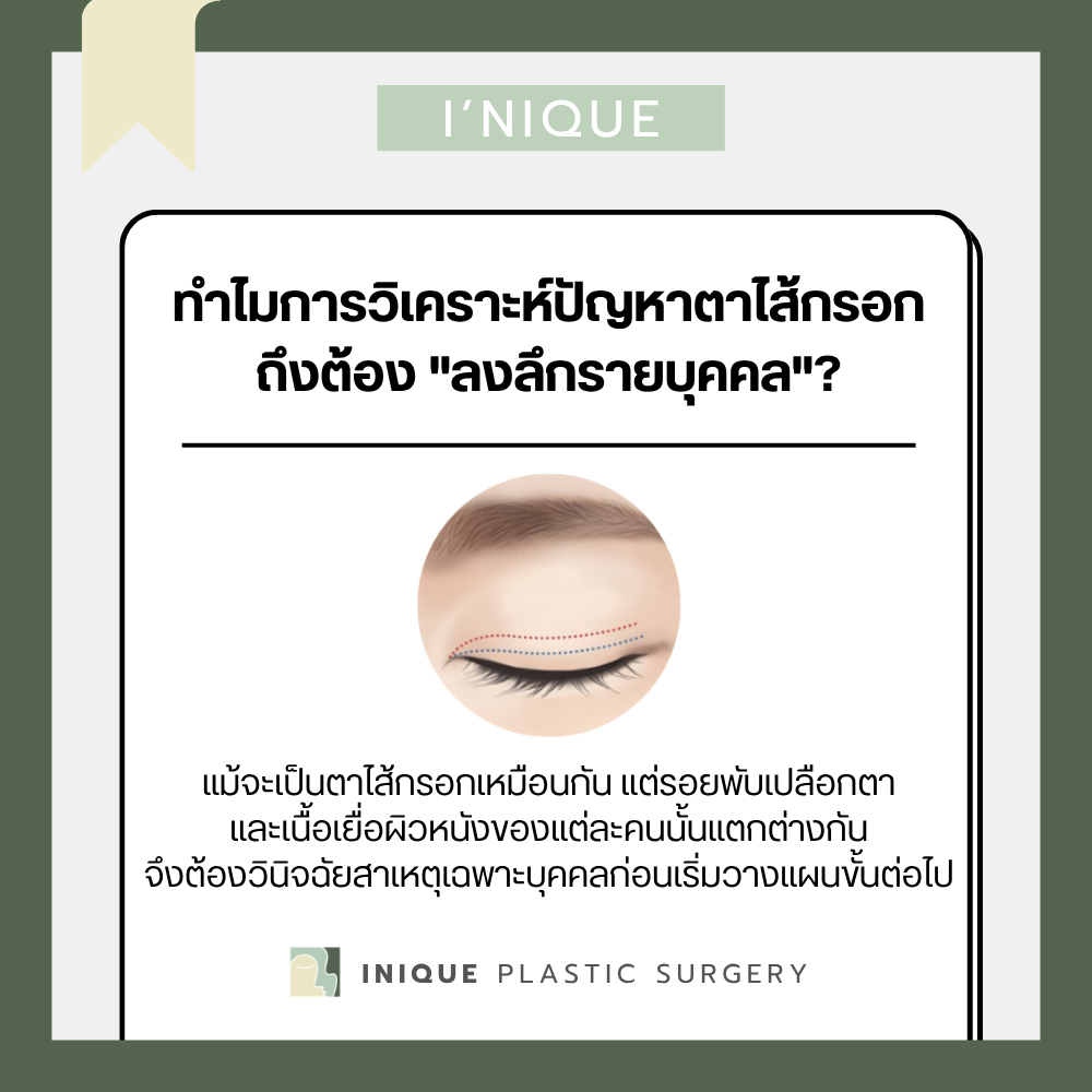 ทำไมการวิเคราะห์ปัญหาตาไส้กรอกถึงต้อง "ลงลึกรายบุคคล"? ก่อน แก้ตาไส้กรอก