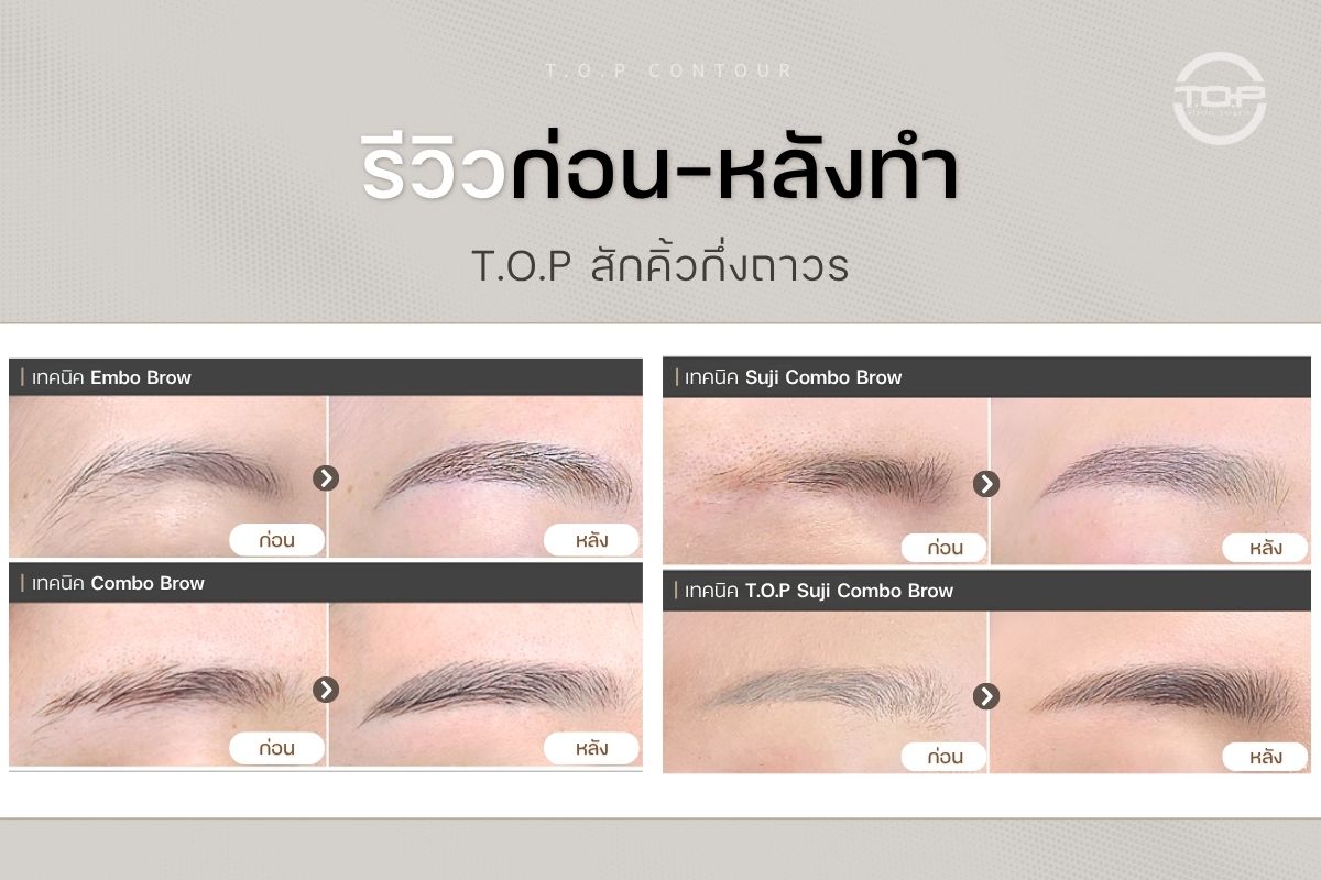 ภาพรีวิว ก่อน-หลัง สักคิ้วกึ่งถาวรที่ T.O.P Plastic Surgery