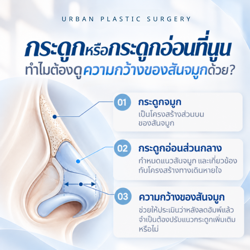 กระดูกหรือกระดูกอ่อนที่นูน ทำไมต้องดูความกว้างของสันจมูกด้วย?