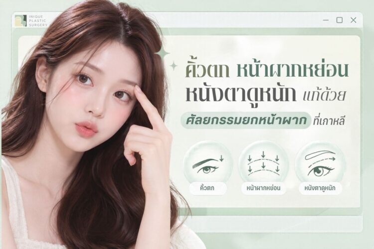 คิ้วตก หน้าผากหย่อน หนังตาดูหนัก แก้ด้วย ศัลยกรรมยกหน้าผาก ที่เกาหลี