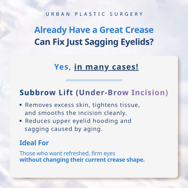 Already Have a Beautiful Double Eyelid Crease? Can a Sub-Brow Lift Correct Sagging Upper Eyelid Skin Without Changing It? 
